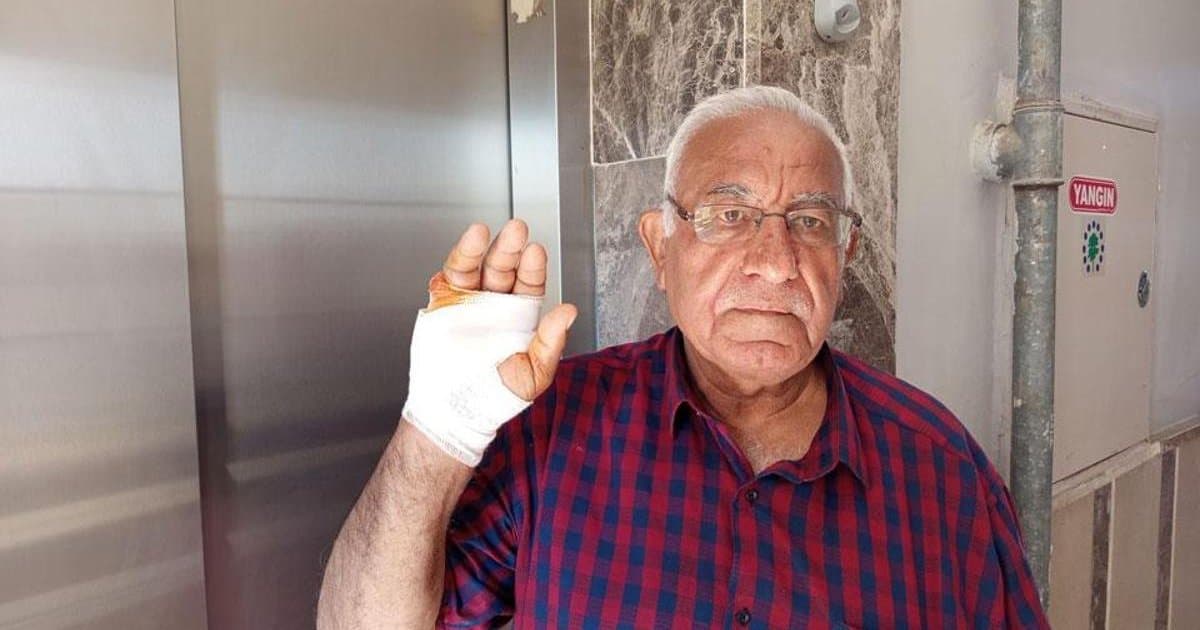 Asansörde komşu dehşeti: Parmağı ampute edildi