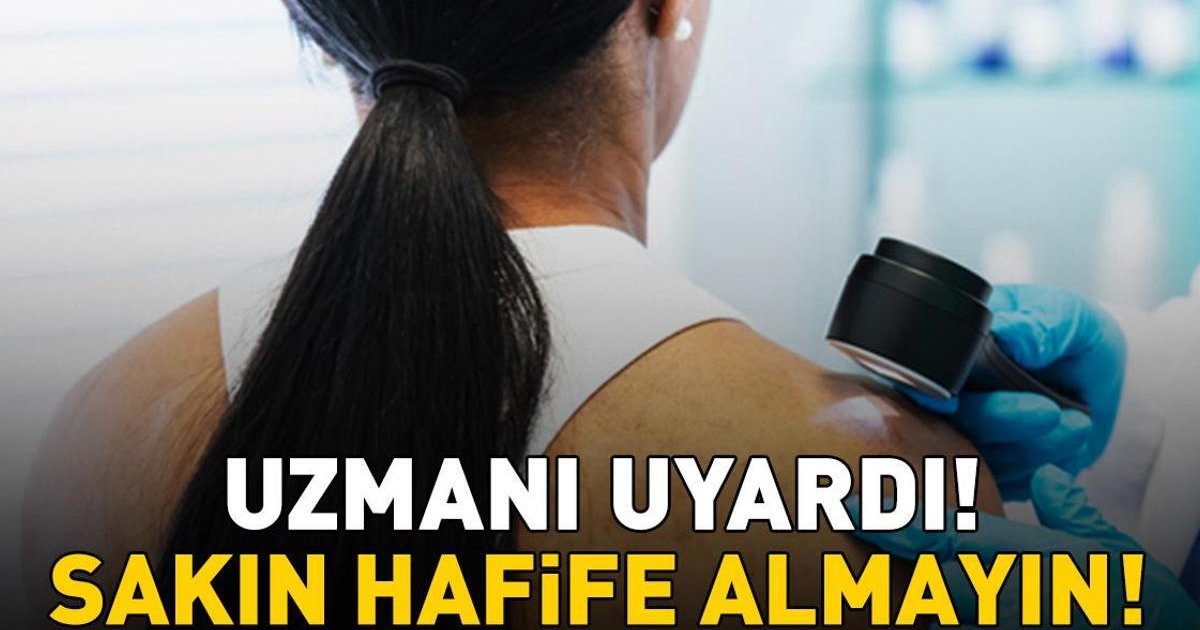 Deri kanseri erken teşhisle önlenebilir