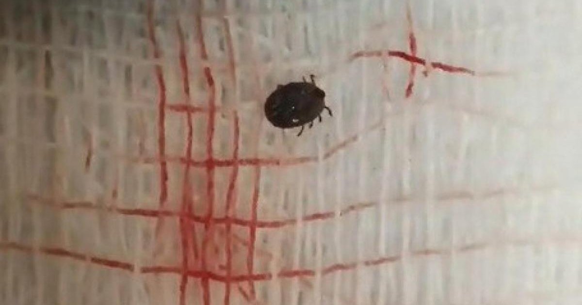 Tokat'ta kene ısırığı: 1 ölü