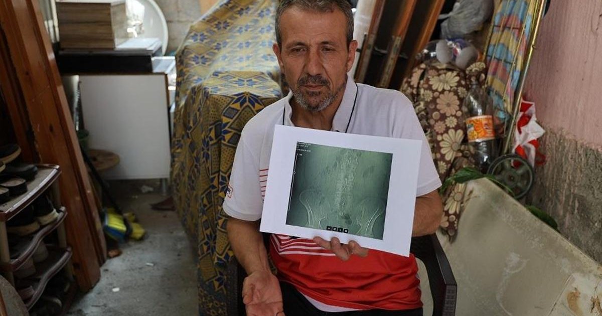 Adana'da ameliyatta panç unutuldu iddiası