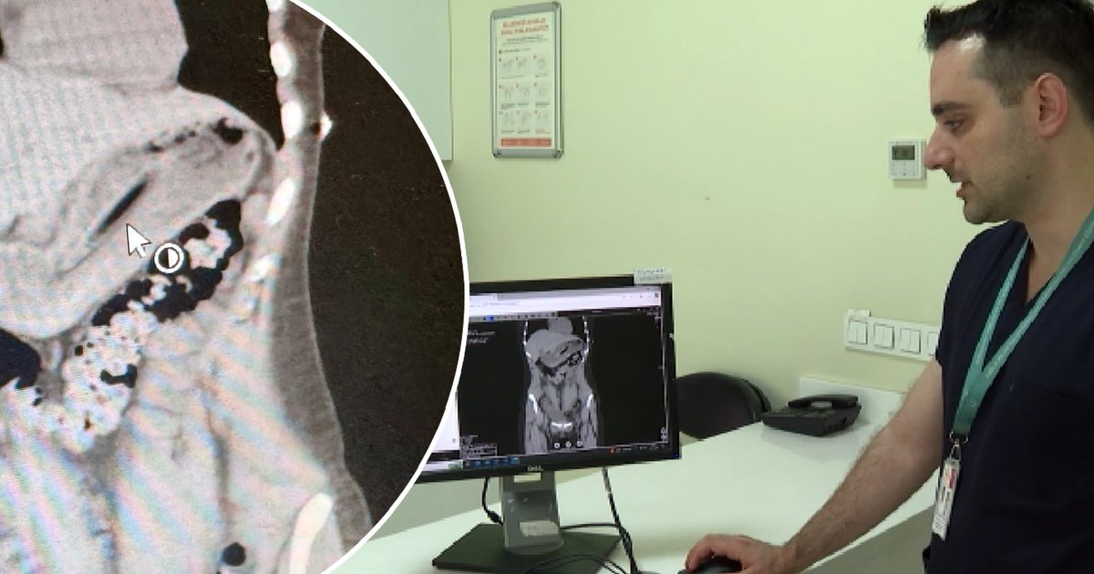 Zayıflamak için diş fırçası yuttu!