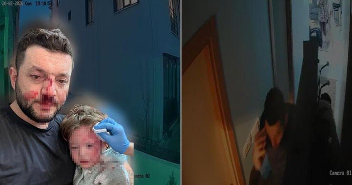 Çınarcık'ta komşular arasında tartışma: Baba ve 14 aylık kızına saldırı