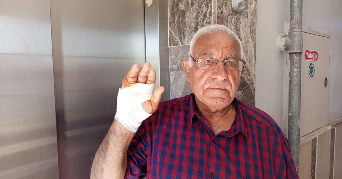 Asansörde komşu dehşeti: Parmağı ampute edildi
