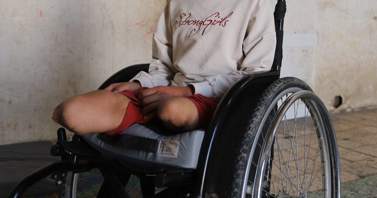 Gazze'de 6 binden fazla kişi protez veya rehabilitasyon bakımına muhtaç