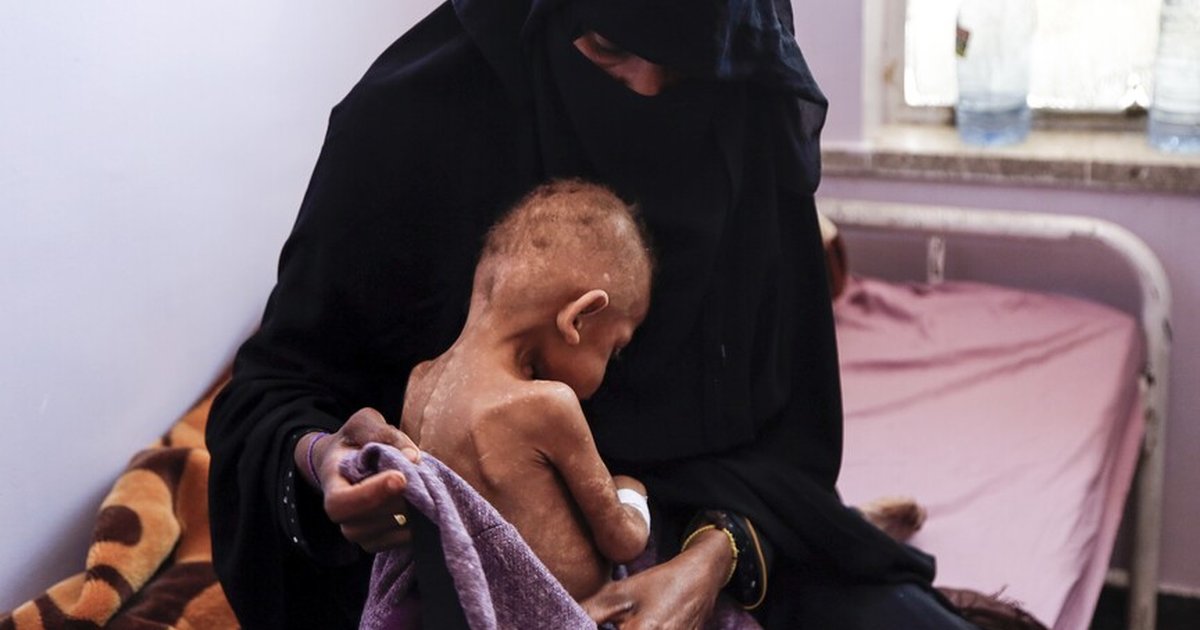 BM'den Yemen'de açlık krizi uyarısı