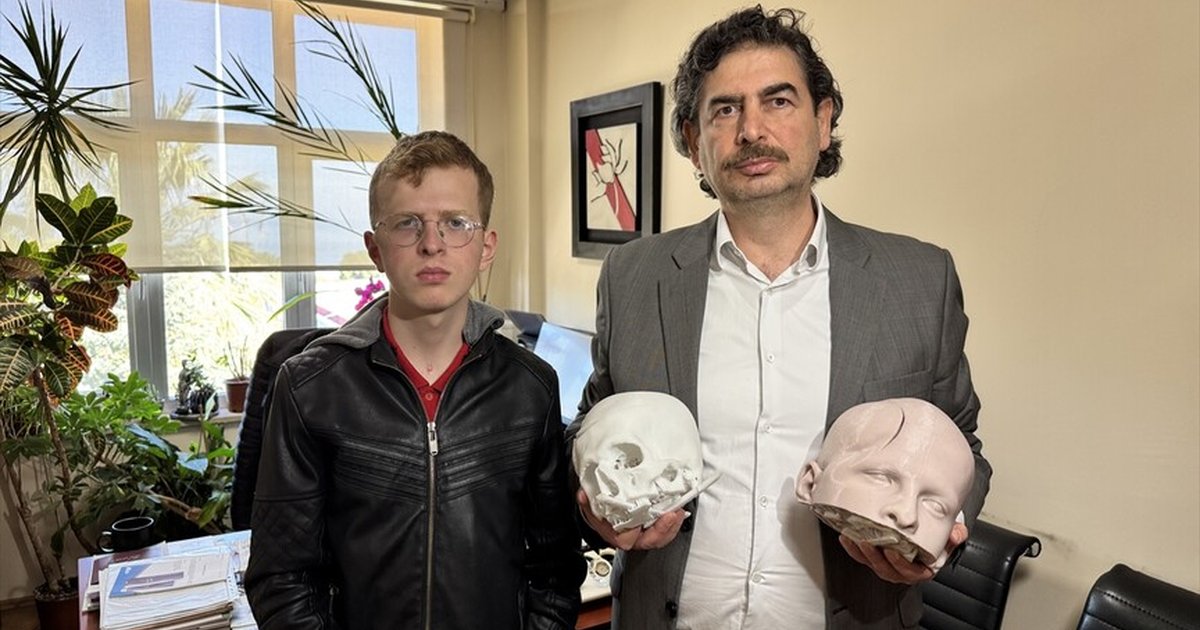 Yüzdeki şekil bozukluğu 3D teknolojiyle düzeltildi