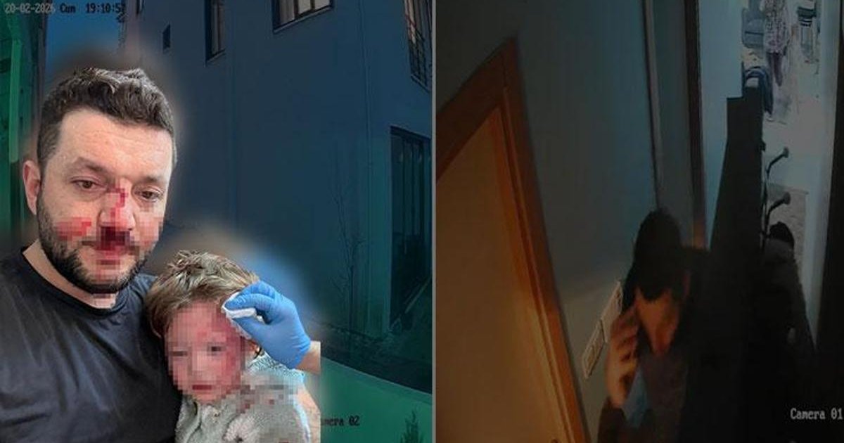 Çınarcık'ta komşular arasında tartışma: Baba ve 14 aylık kızına saldırı